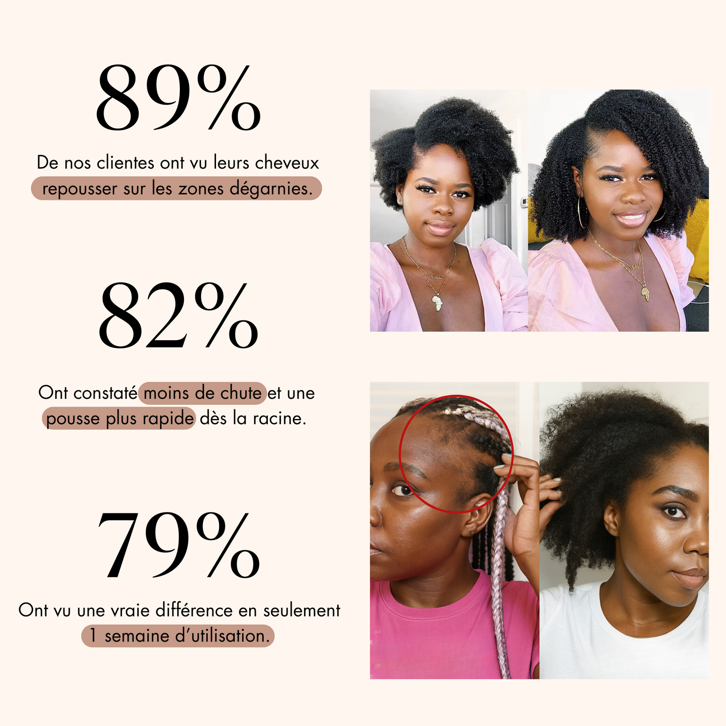 Le soin N°1 pour booster la pousse