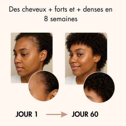 Le soin N°1 pour booster la pousse