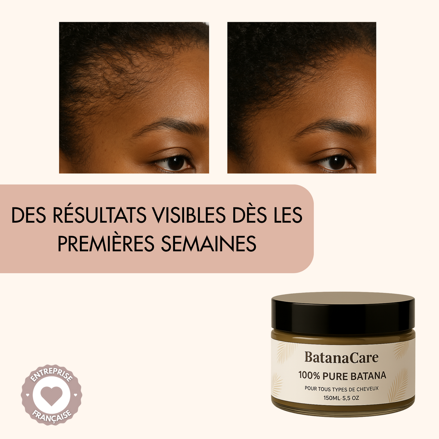Le soin N°1 pour booster la pousse